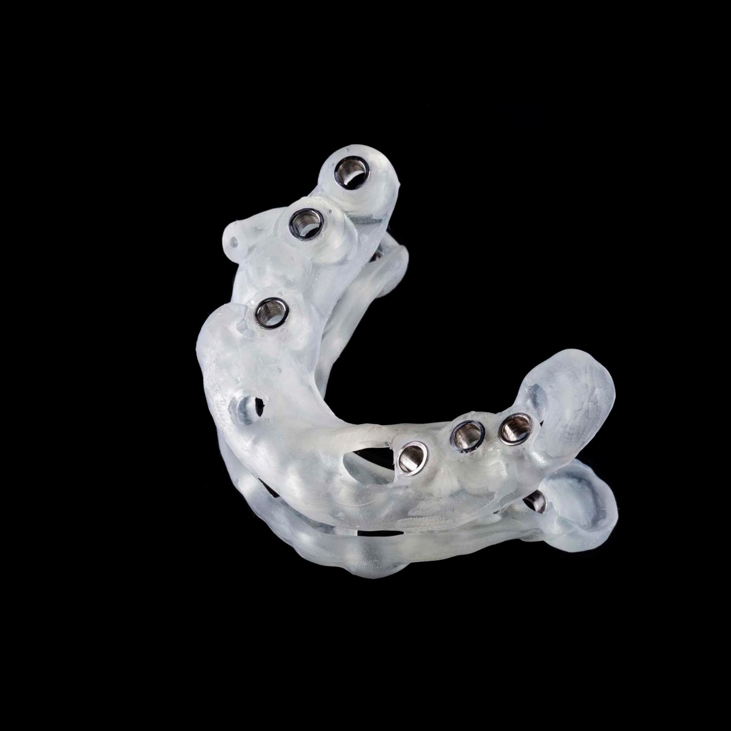 Cirugía guiada de implantes dentales en Alcorcón: precisión avanzada, menos invasiva y con resultados estéticos y funcionales inigualables