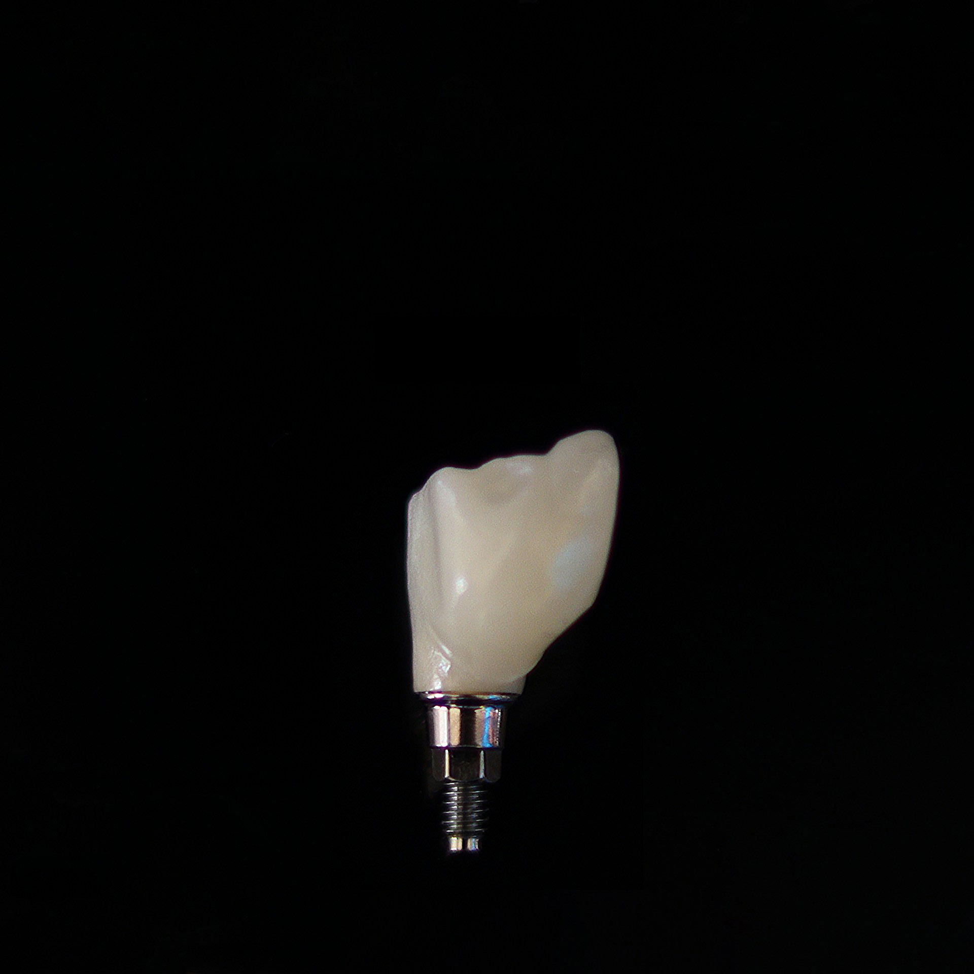 implantes-dentales-carga-inmediata-alcorcon Dentista Especialista en Implantes de Carga Inmediata en Alcorcón